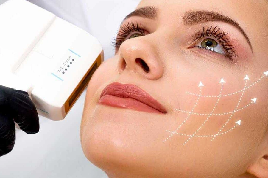 Máquina UltraLift SD Compact HIFU para tensar la piel sin cirugía