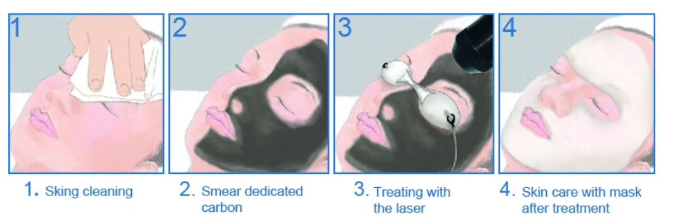 PROCEDURE