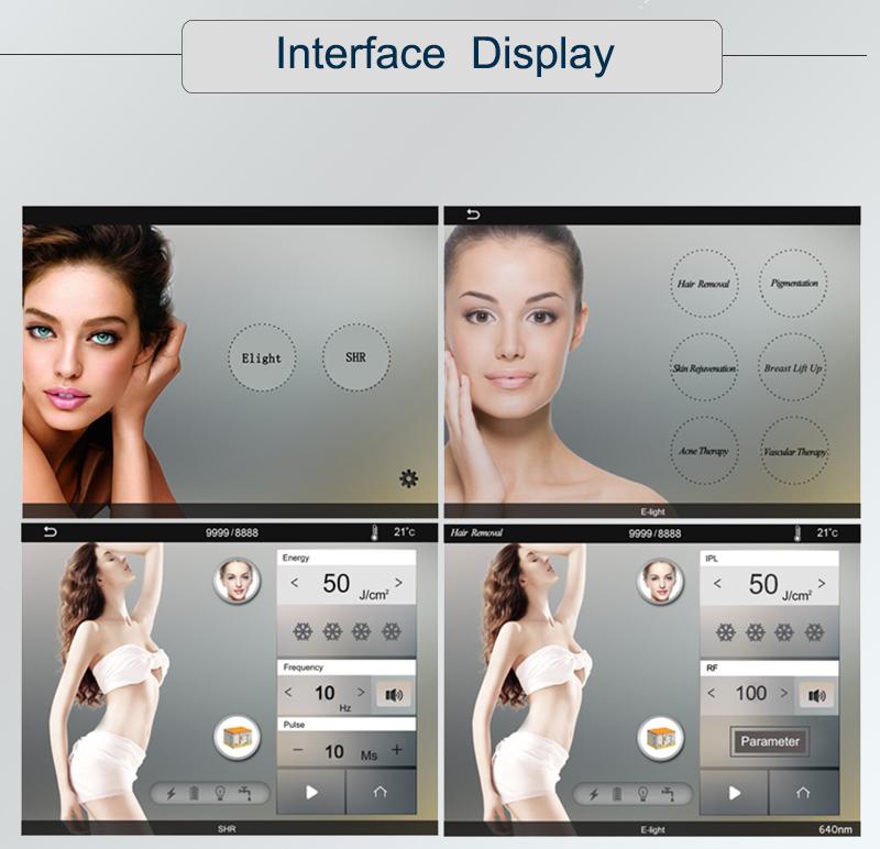 interface