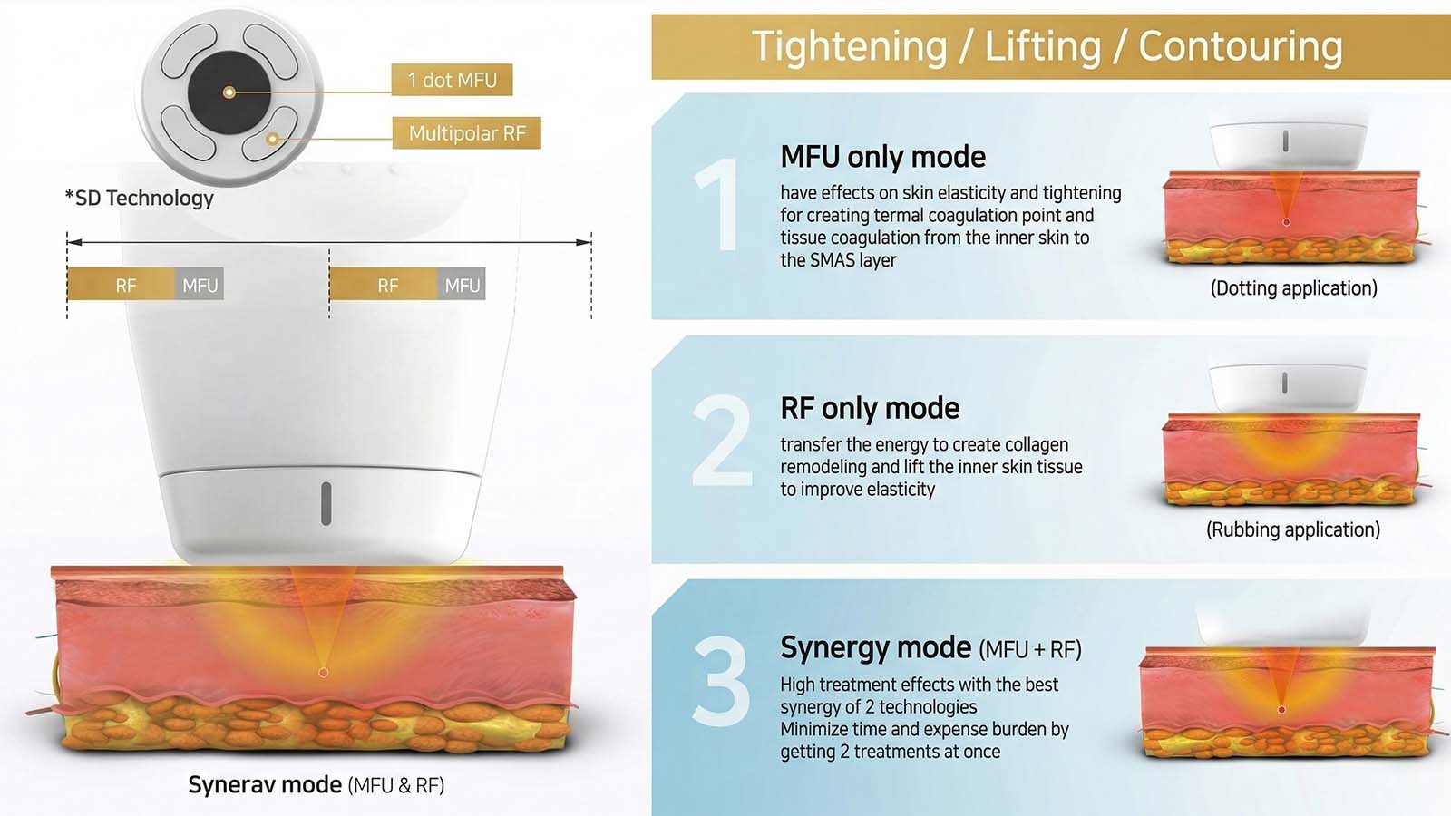 Diagram illustrating the synergy of Micro-Focused Ultrasound and Radio Frequency technologies within the advanced RF HIFU machine treatment head.