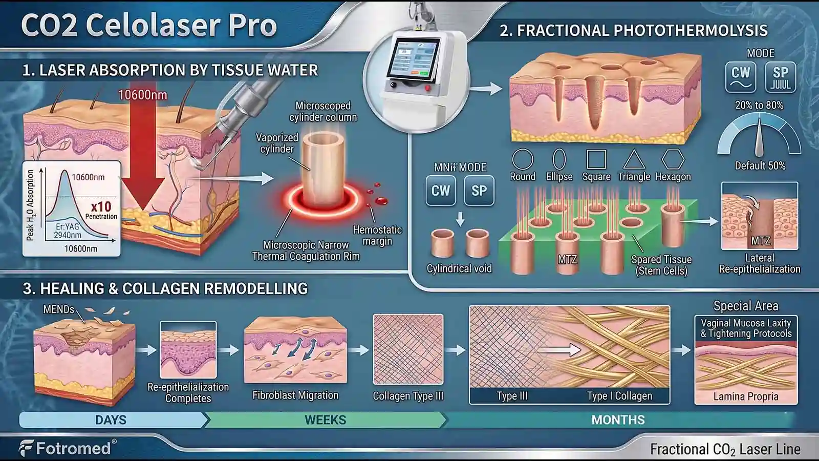 How the CO2 Celolaser Pro Laser Works
