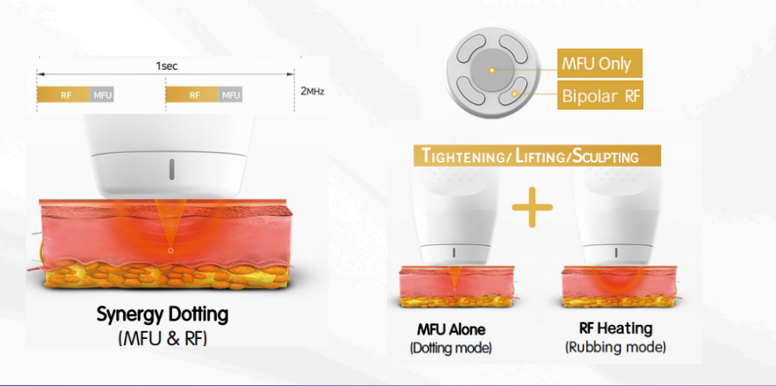 MFU&RF handles principle