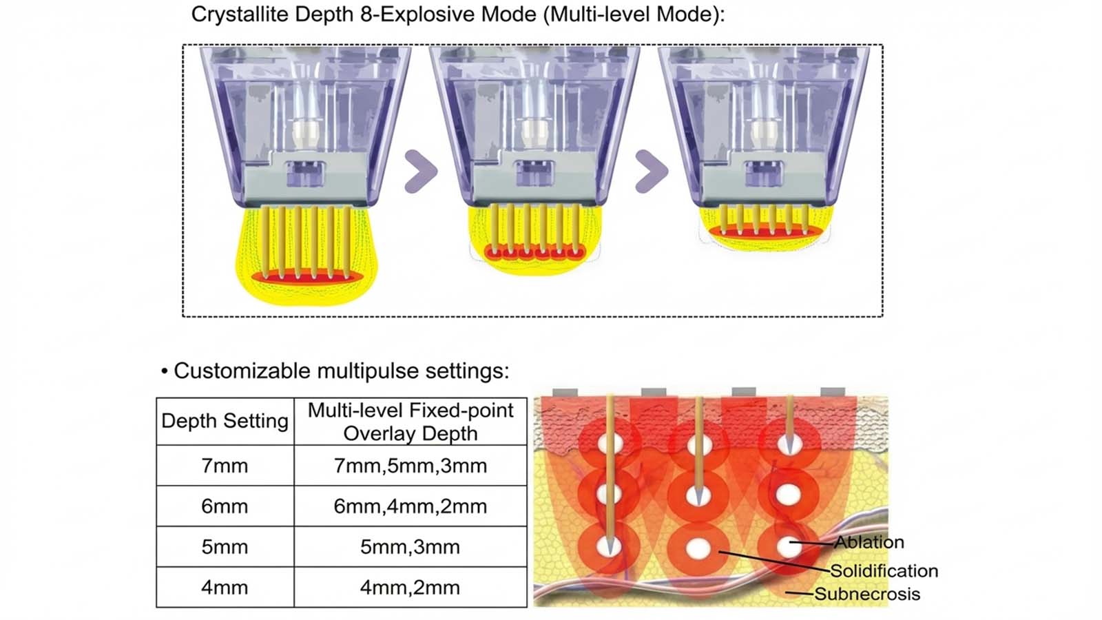 Портативная глубина кристаллита 8 Схема настройки многоуровневой радиочастотной глубины станка.