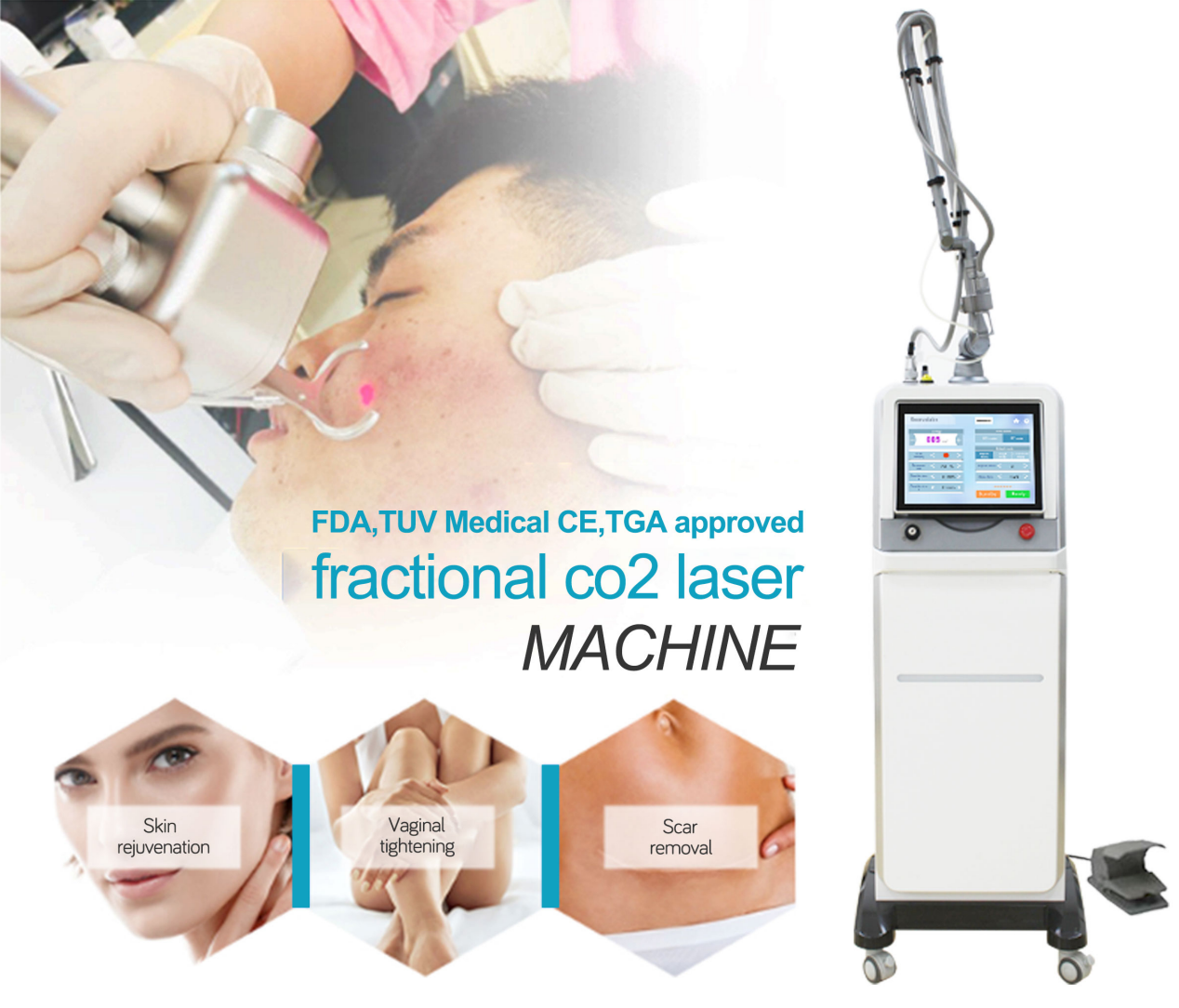 fractional CO2 Laser