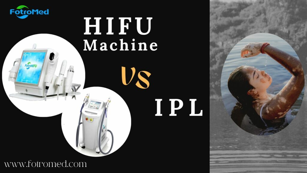 HIFU machine vs IPL