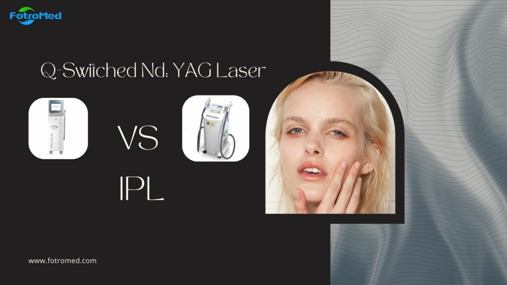 Q Switched NdYAG Laser vs IPL