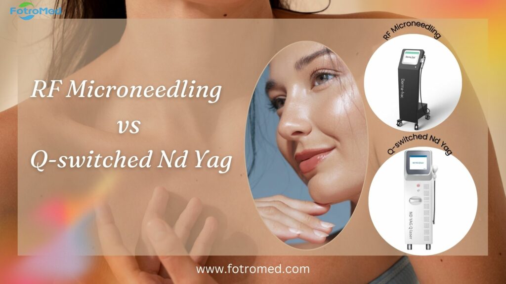 RF Microneedling vs Q switched Nd Yag