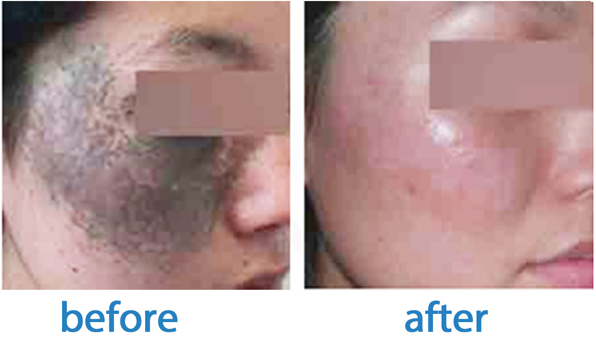 B&A (1)