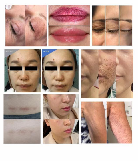 before & after