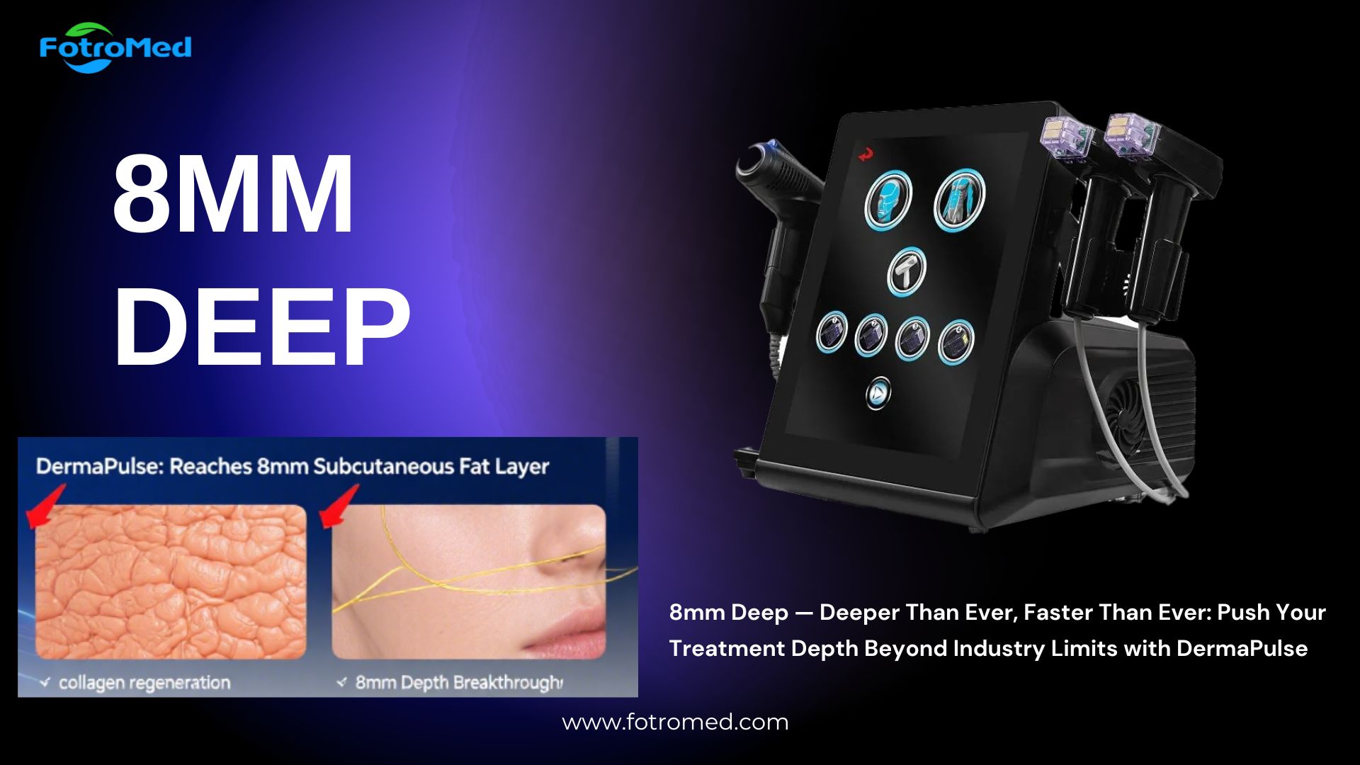 8mm Deep — Deeper Than Ever, Faster Than Ever Push Your Treatment Depth Beyond Industry Limits with DermaPulse