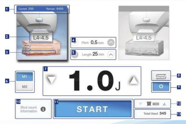 0094be0bab8ffa9758b47756354ac0c4