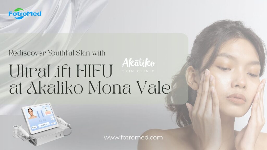 アカリコ モナ ベールのウルトラリフト HIFU で若々しい肌を再発見