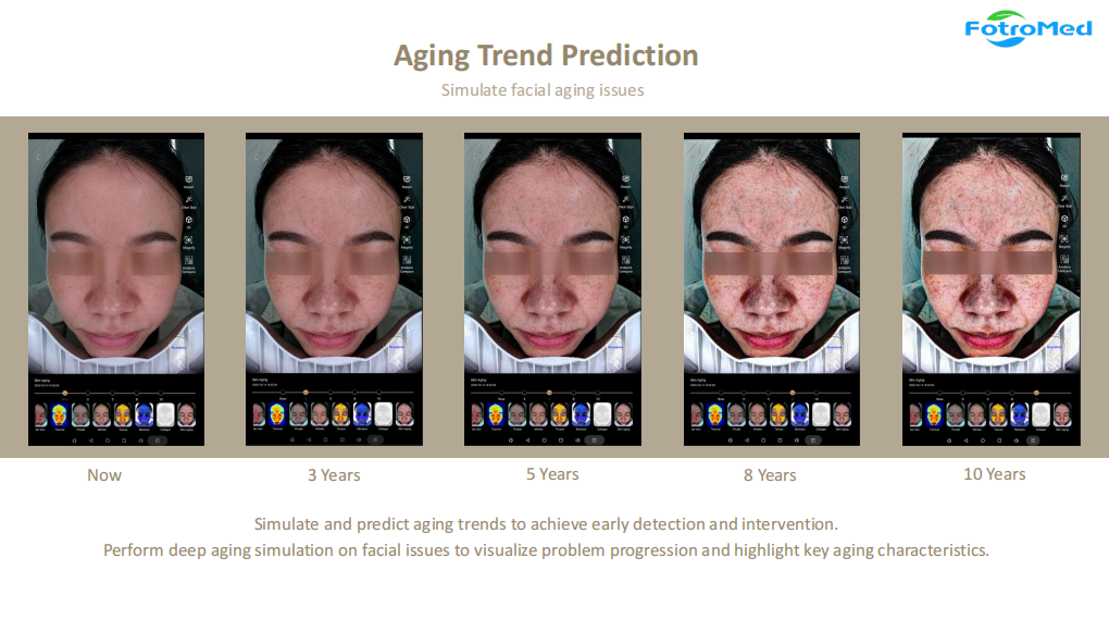 aging Trend Prediction