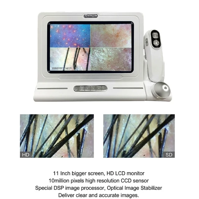 scalp analysis machine front (1)