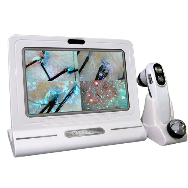 scalp analysis machine front 2