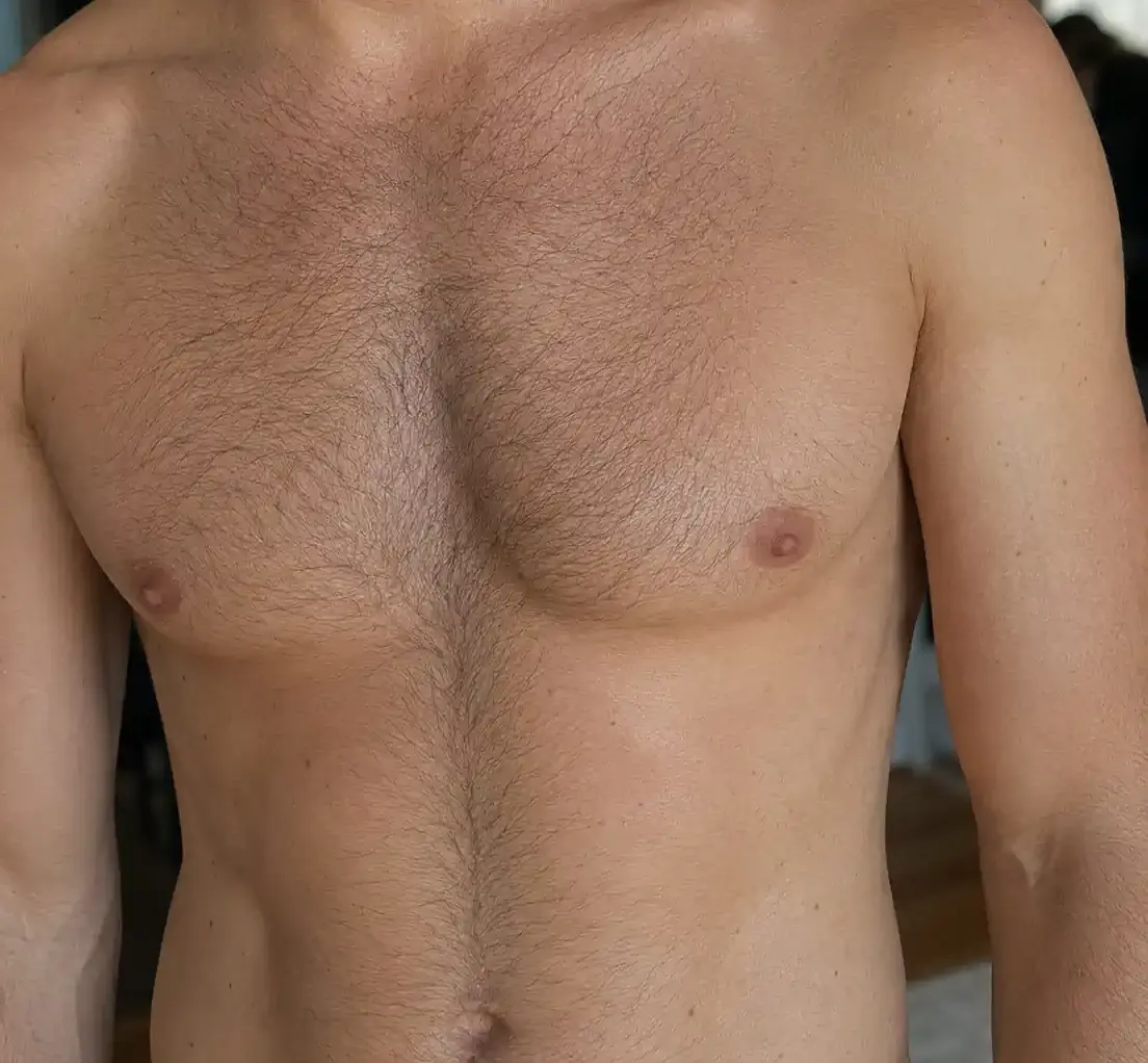 chest-hair-before-laser-hair-removal-closeup