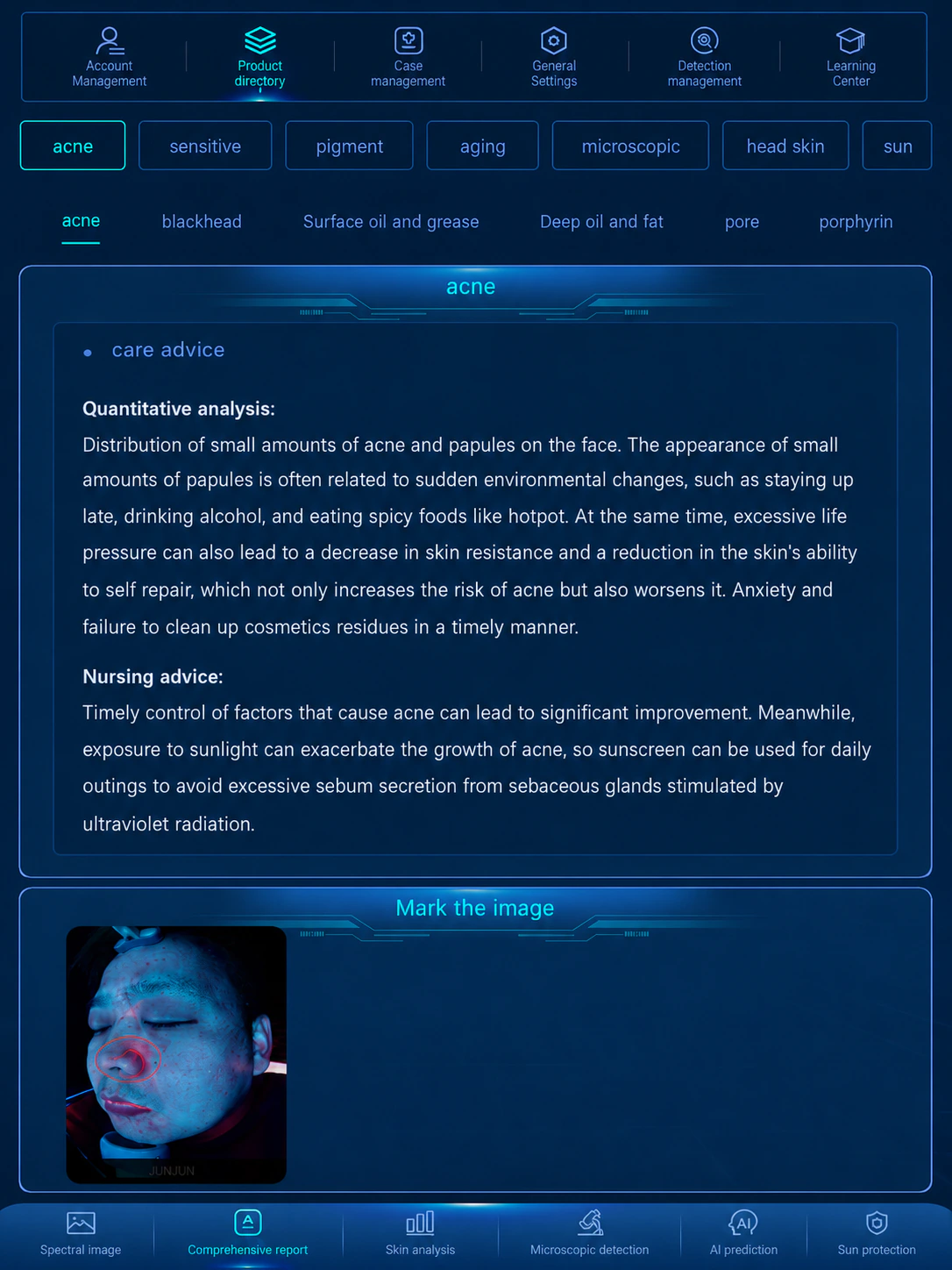 UV spots spectral view report screenshot