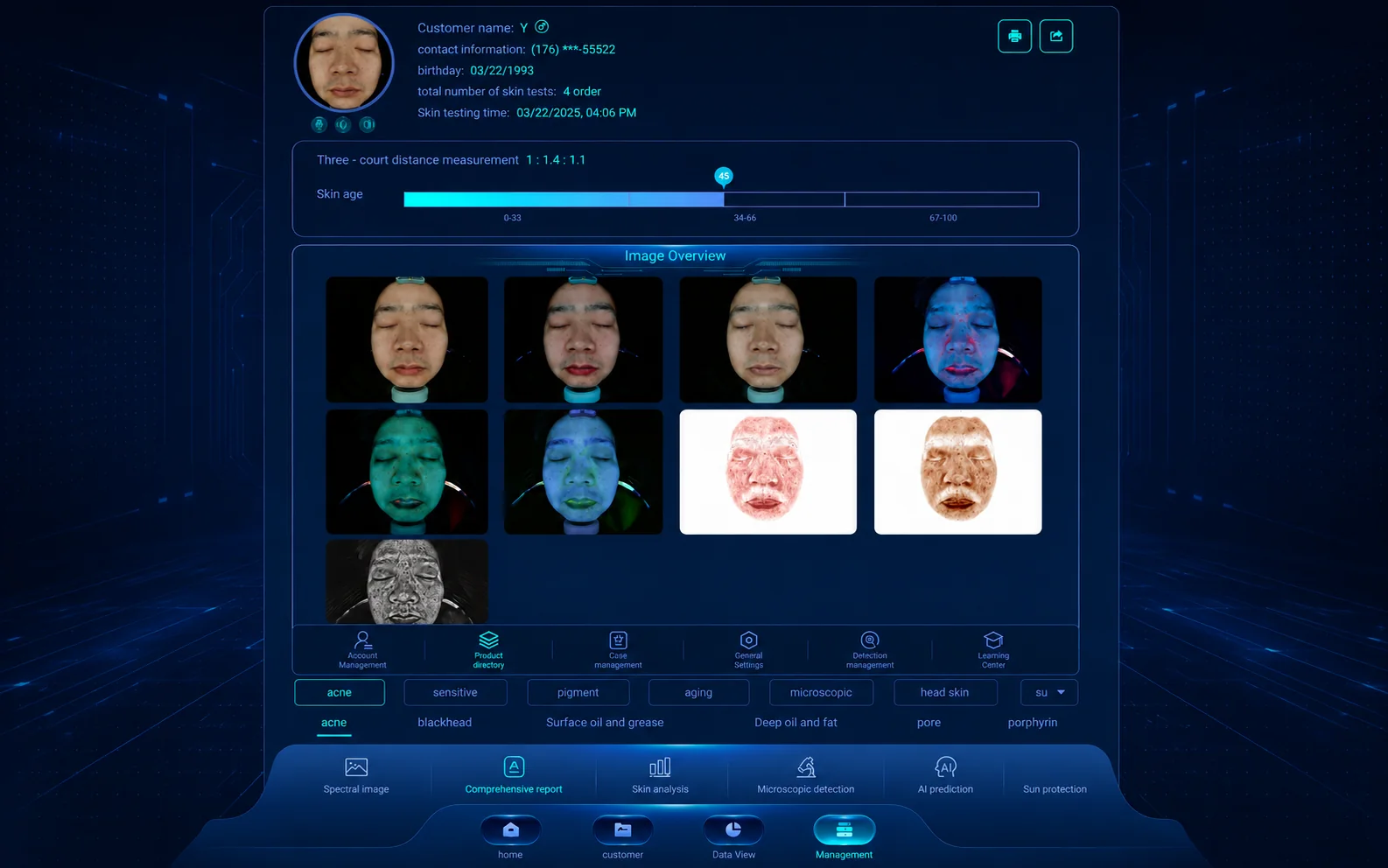 Derma Vision Master skin detection report for clinic consultation