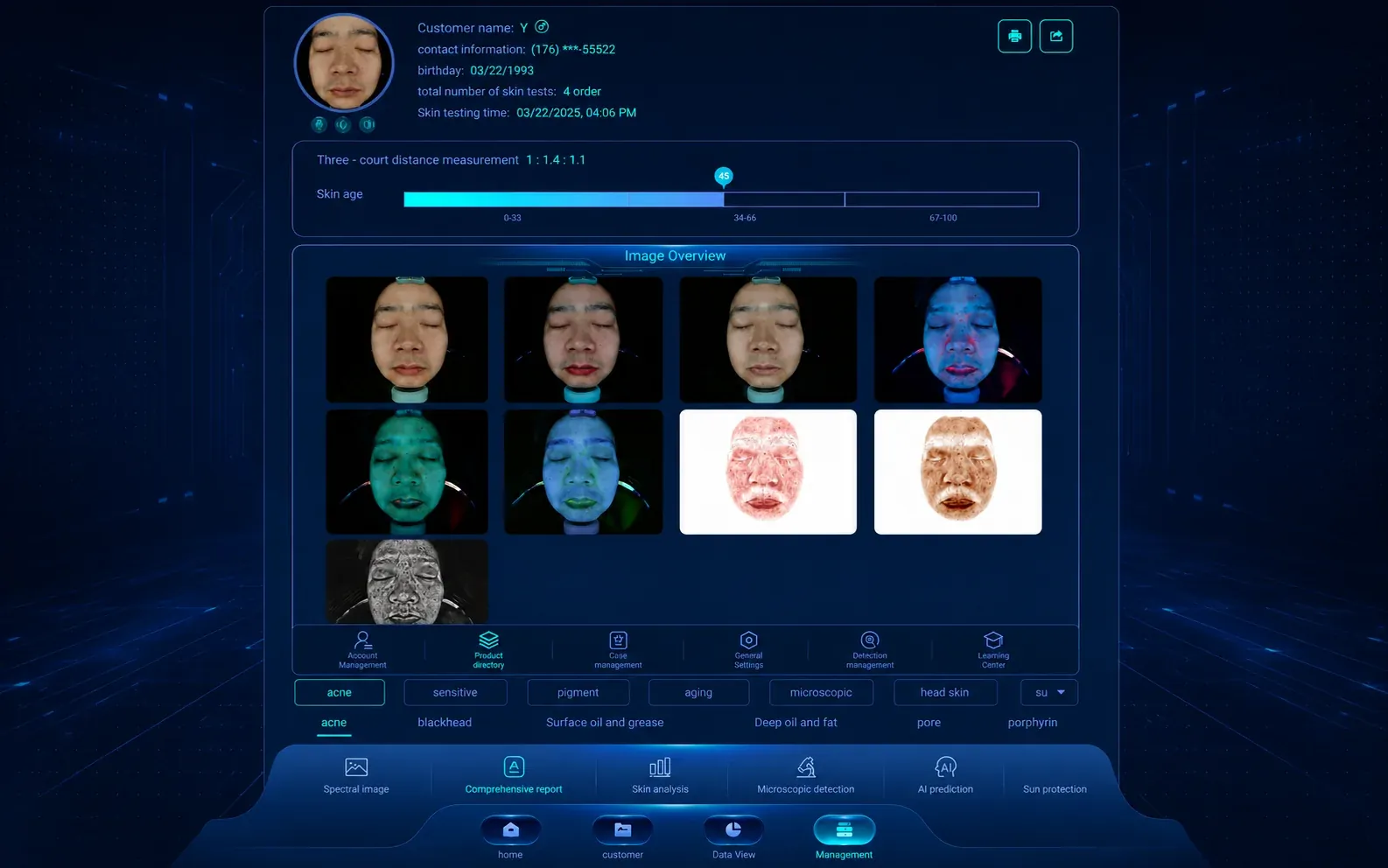 DermaVision Master X5 Pro skin detection report for clinic consultation